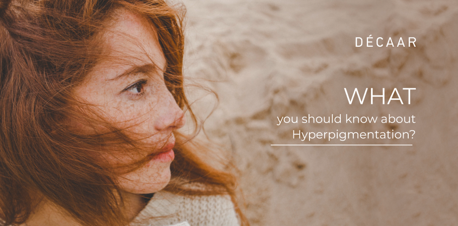 What you should know about Hyperpigmentation?